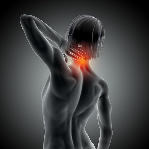 Anatomical image of a person holding their neck in pain, with the affected area highlighted.