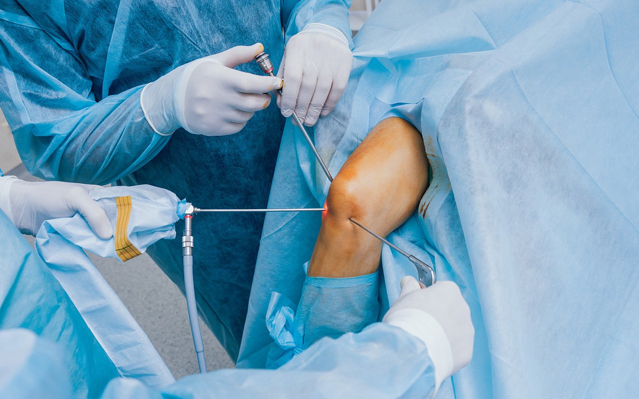 Surgeons performing minimally invasive arthroscopic knee surgery on a patient’s knee in an operating room.