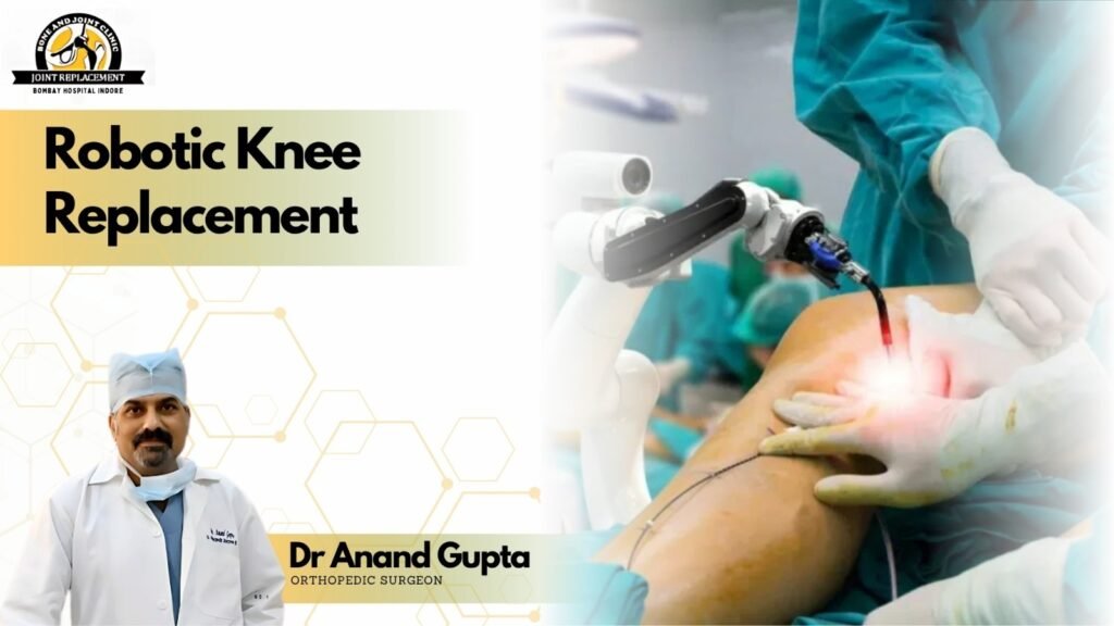 Robotic Knee Replacement surgery with Dr Anand Gupta performing advanced knee joint procedure in Indore.