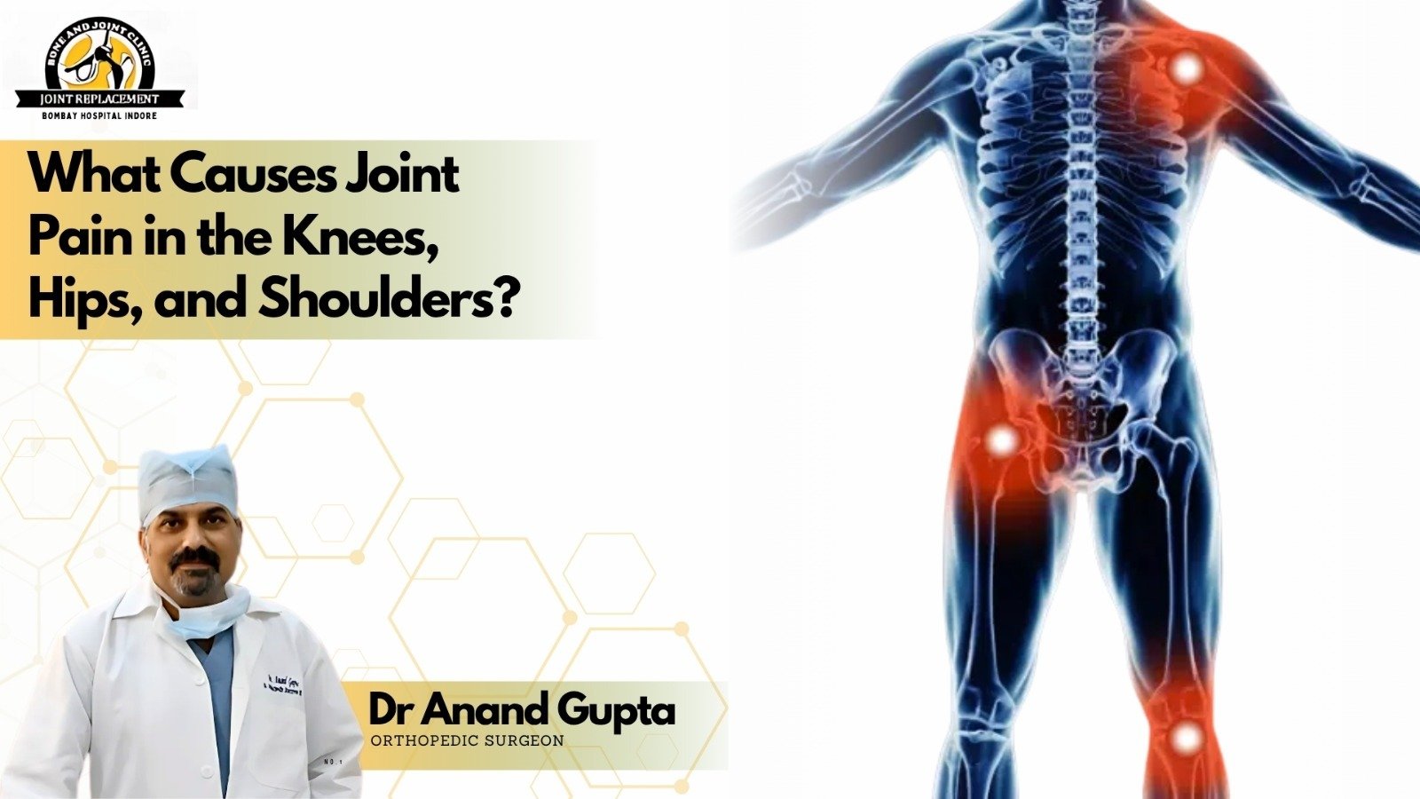 Human skeletal body showing highlighted knee, hip, and shoulder pain areas with Dr Anand Gupta orthopedic surgeon photo.
