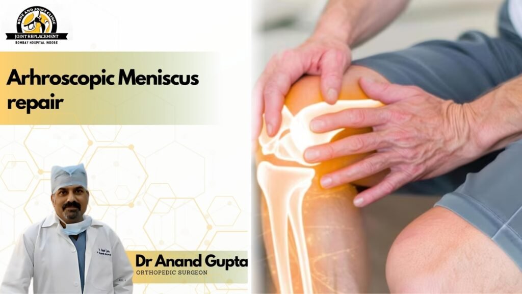 Arthroscopic meniscus repair illustration showing knee joint pain with Dr Anand Gupta orthopedic surgeon Indore
