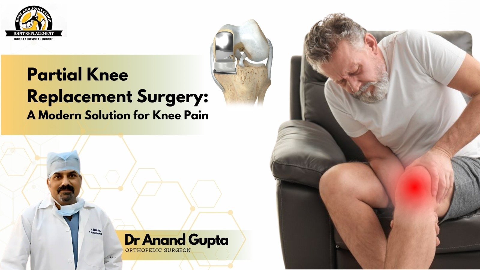 Banner about partial knee replacement surgery featuring Dr Anand Gupta, an orthopedic surgeon, with an image of a man suffering from knee pain and a knee implant illustration.