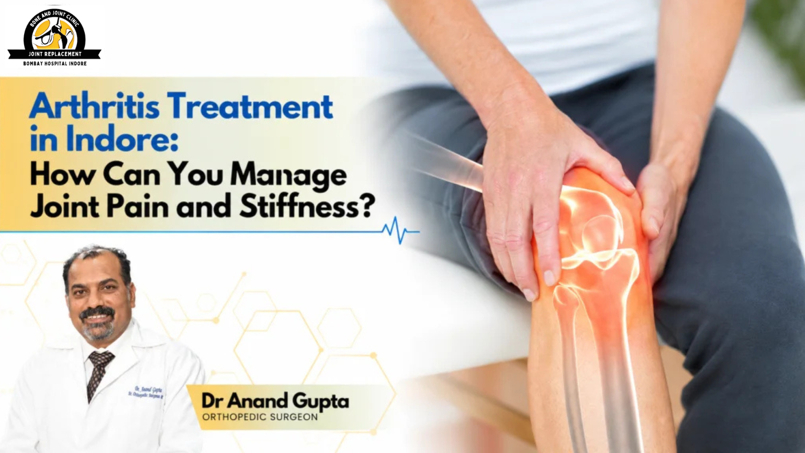 Arthritis treatment tips infographic for joint pain and stiffness management